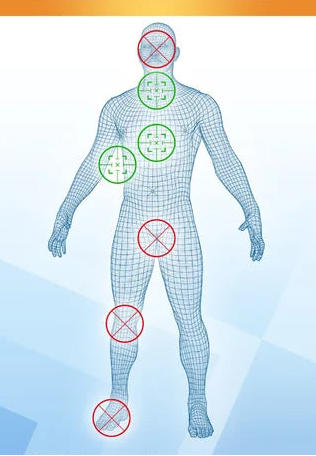 EndWarts Extra fibroid cryotherapy 14.3 g