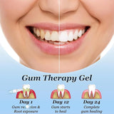 Lovilds Gum Therapy Gel 4 x 10 ml
